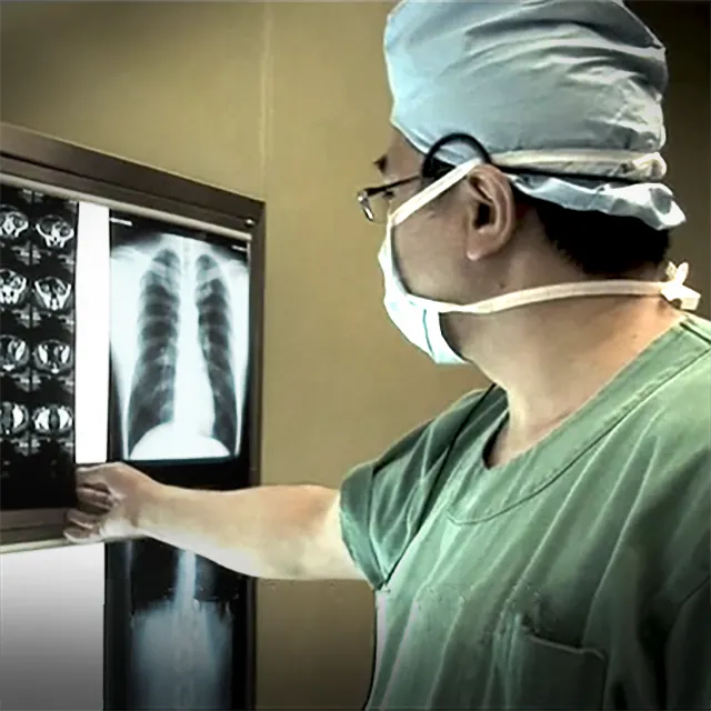 【Expert Files】腹腔鏡補助下低位前方切除術