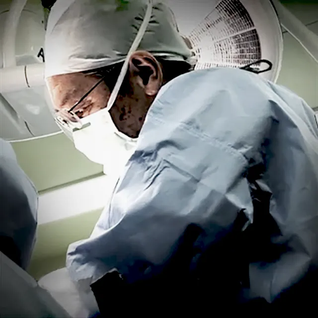S状結腸切除術
